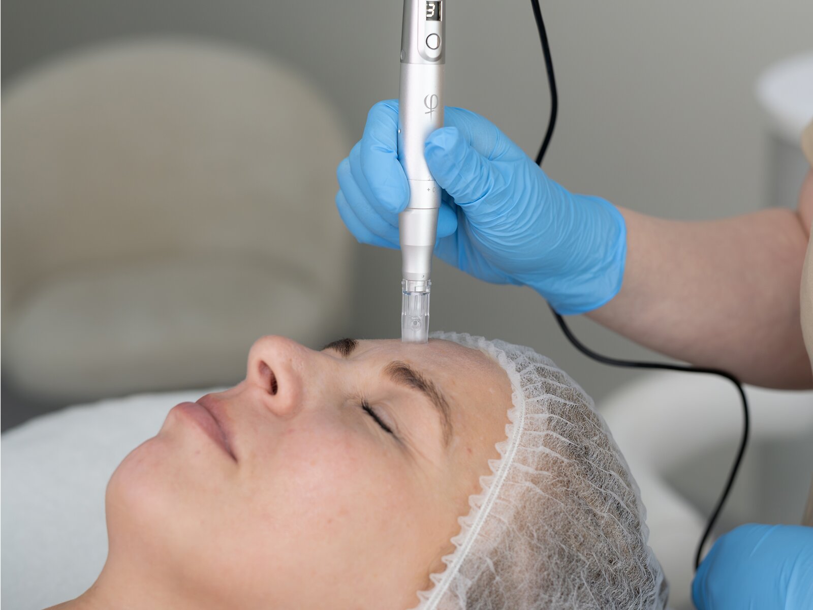 Micro Needling