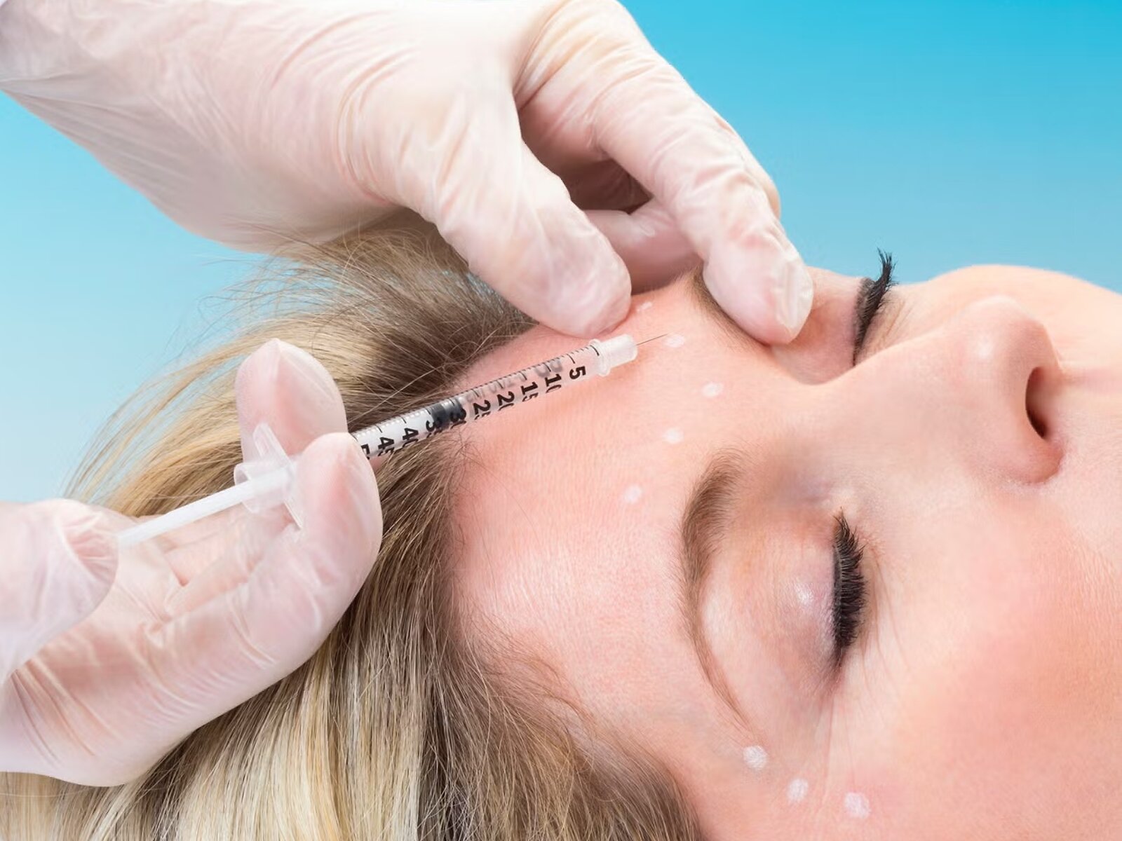 Botox en fillers bij Skin Renew