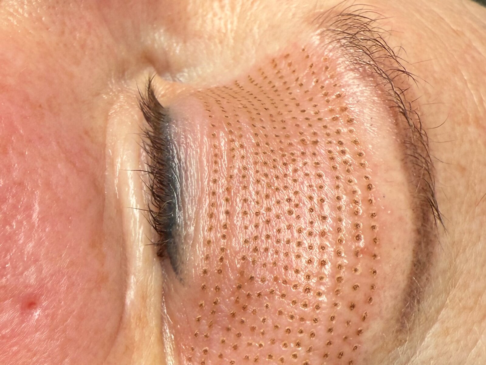 Phi-Ion Plasma Lift