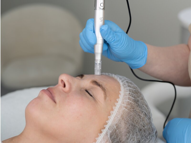 Micro Needling