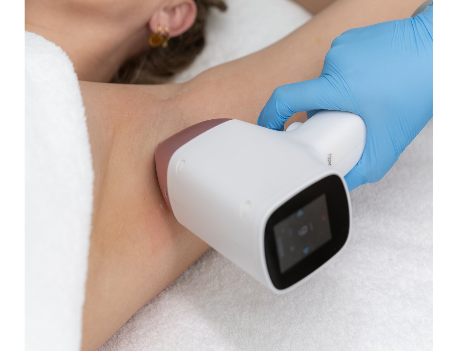 Laserontharing